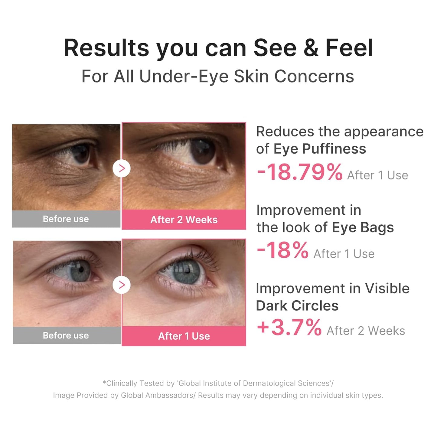 Parche para Ojos KLEAR PDRN Cafeína Colágeno