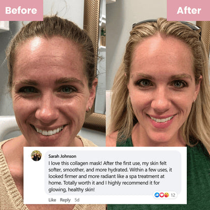 Mascarilla Envolvente de Noche con Colágeno (#1 Más Vendido)