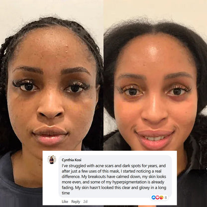 Mascarilla Envolvente de Noche con Colágeno (#1 Más Vendido)